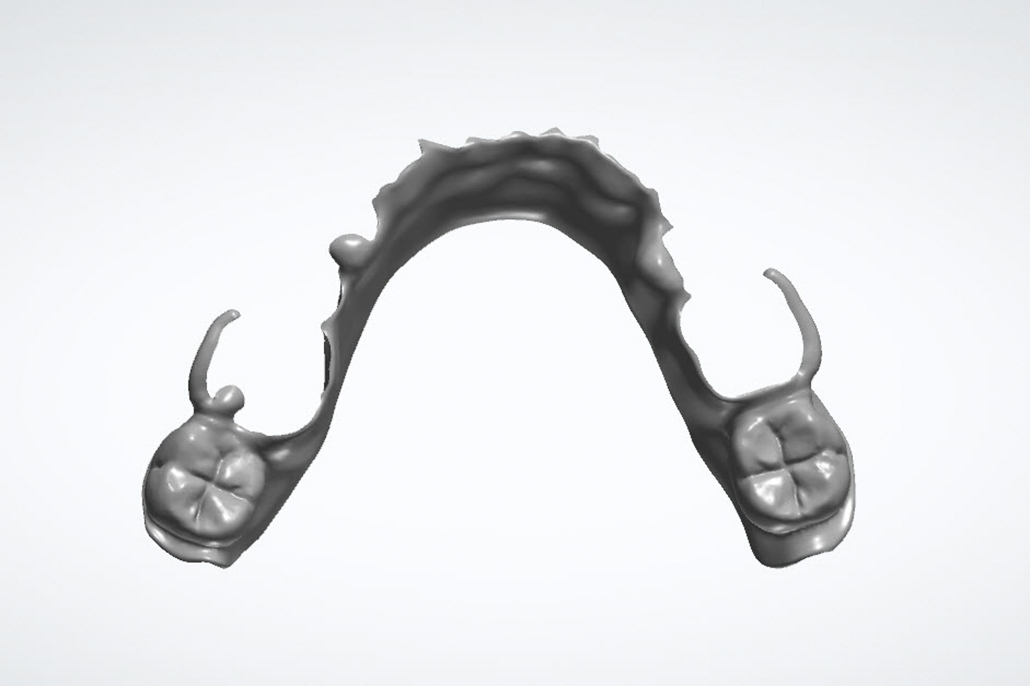 denture