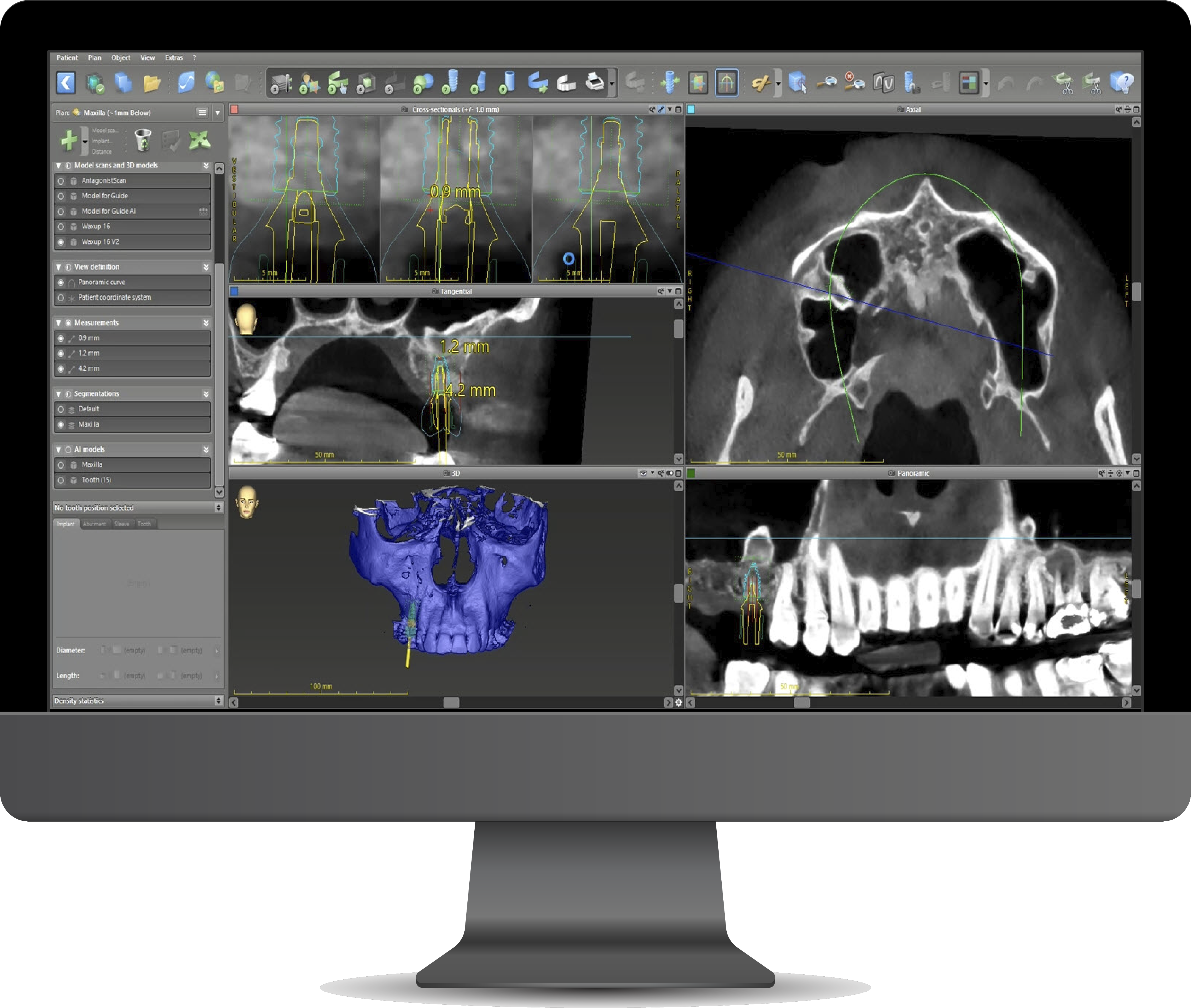 codiagnostix surgical guide
