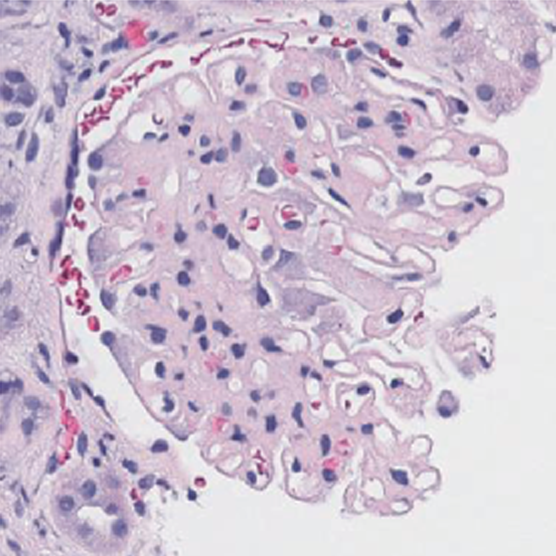 H&E tissue image