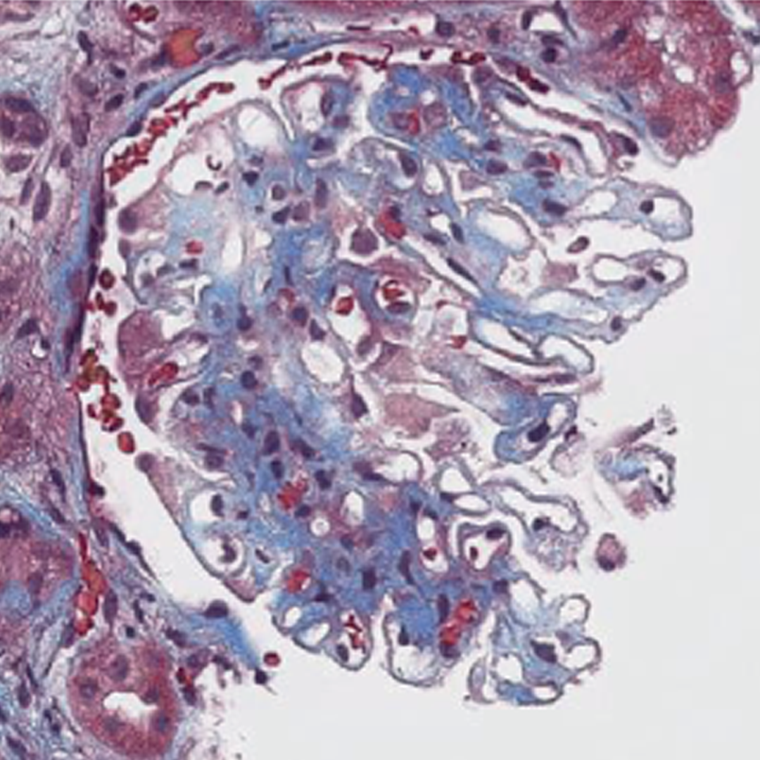 Masson's Trichrome thumbnail