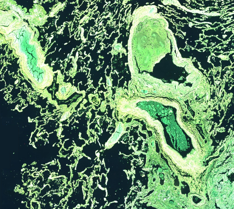 Autofluorescence tissue image