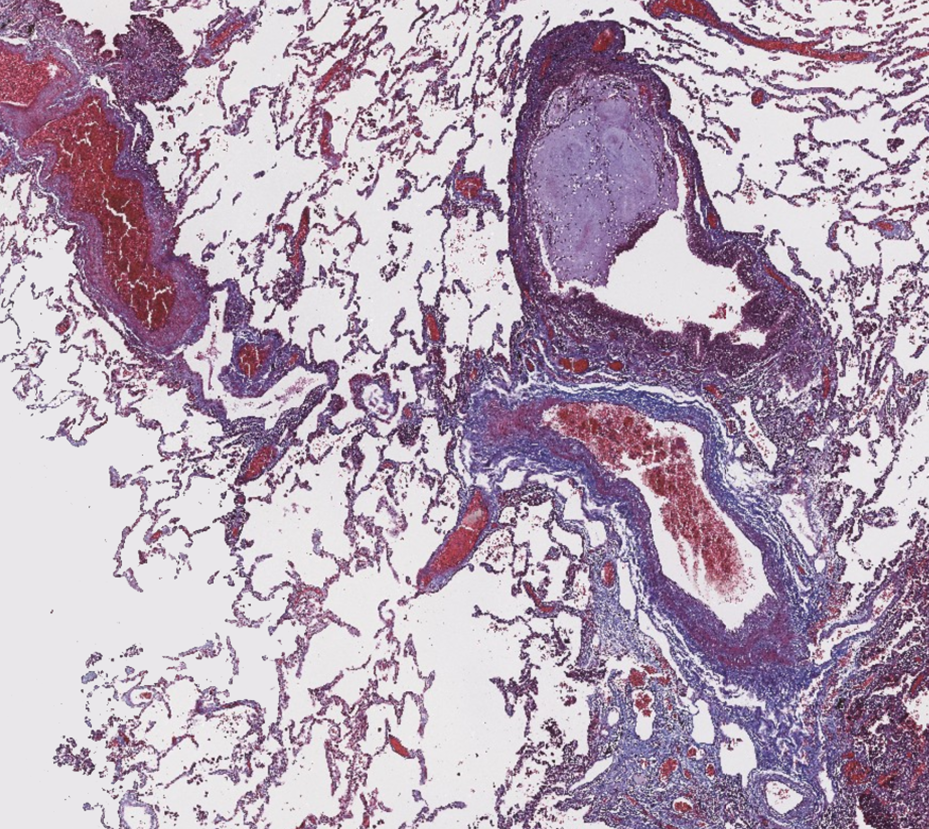 Masson's Trichrome thumbnail