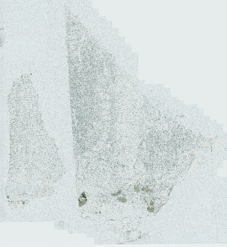 Brightfield tissue image