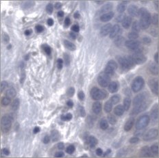 Virtual Napsin A stain