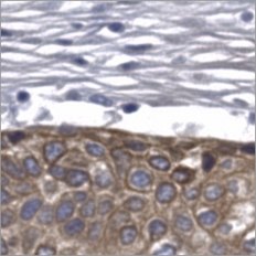 Virtual CK5/6 stain