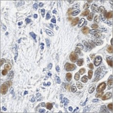 Virtual p53 stain