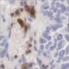 Virtual CD45 stain