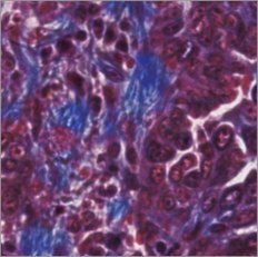 Virtual Trichrome stain