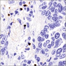 Virtual CD8 stain