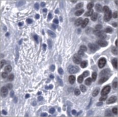 Virtual TTF-1 stain
