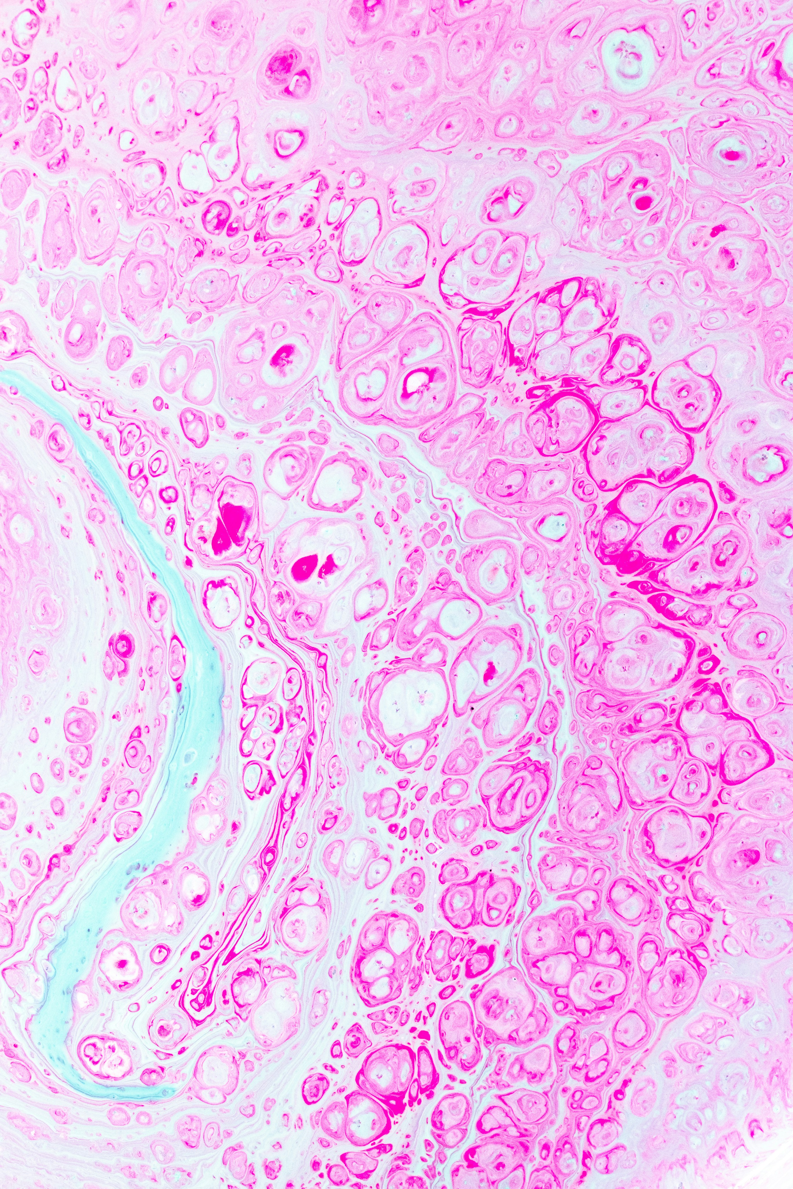 Pathology slide photo
Solein Feyissa