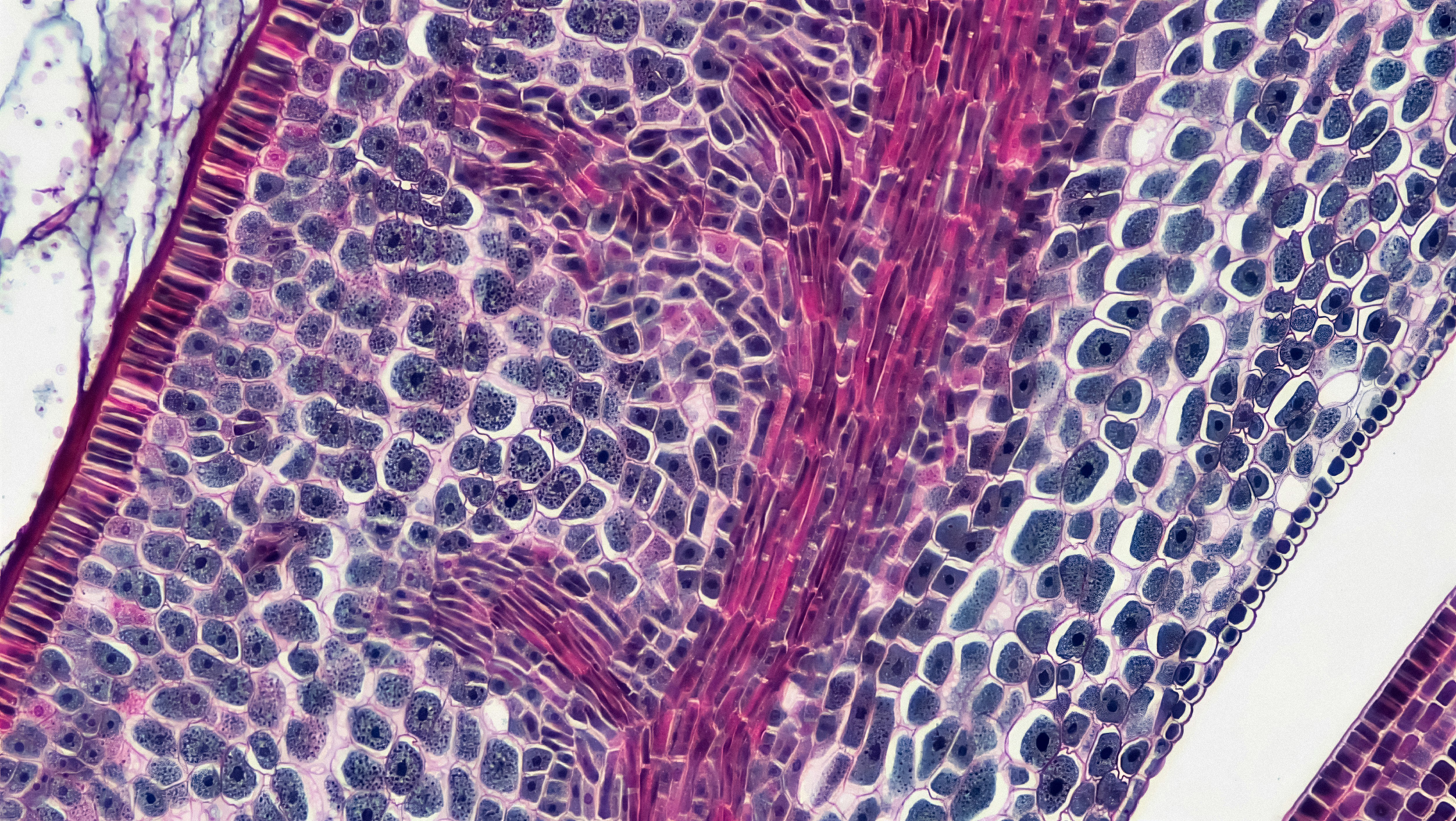 Pathology slide. Credit Bioscience Image Library by Fayette Reynolds