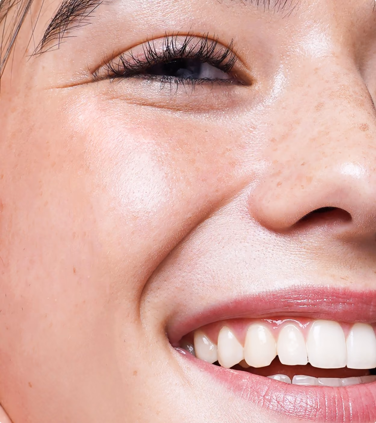 Close-up of a smiling person's face showing smooth skin, freckles, and white teeth.
