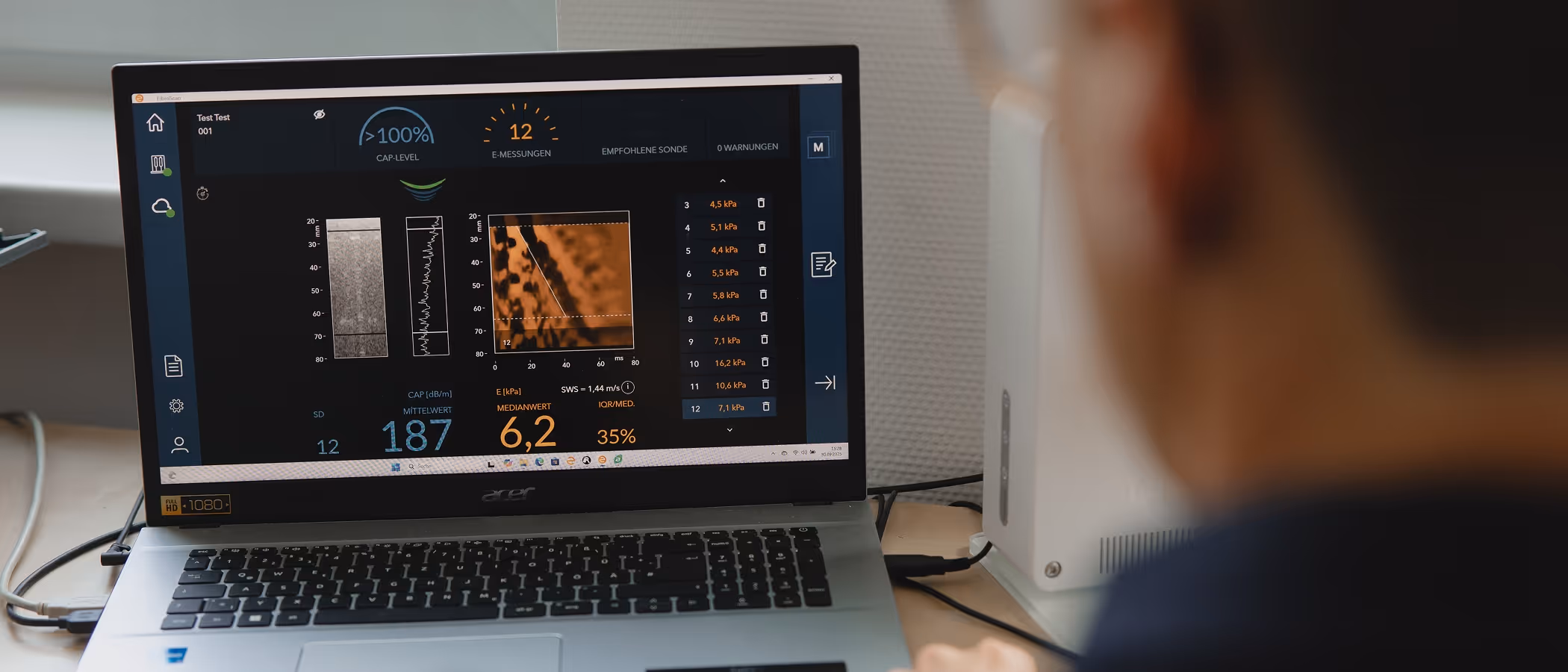 Laptop zeigt Software zur Messung von CAP-Level, E-Messungen und kPa-Werten mit Grafiken und Tabellen.