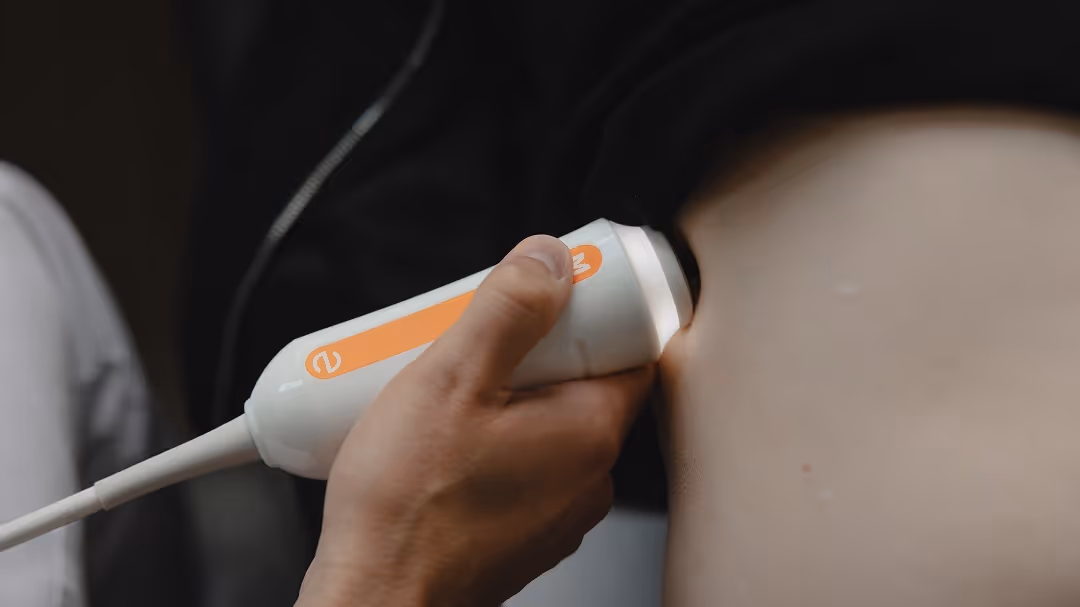 Hand hält einen Ultraschallsondenkopf, der auf den Bauch einer Person aufgesetzt ist.