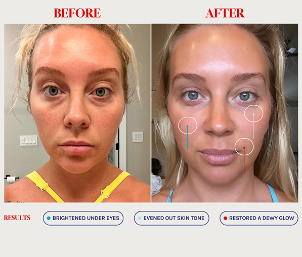 Side-by-side before and after photos of a woman’s face showing brighter under eyes, evened skin tone, and a restored dewy glow after skincare treatment.