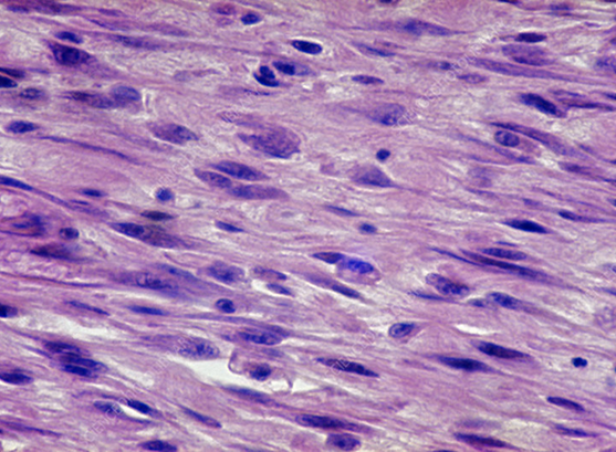 Microscopic view of elongated spindle-shaped cells typical of smooth muscle tissue stained purple.