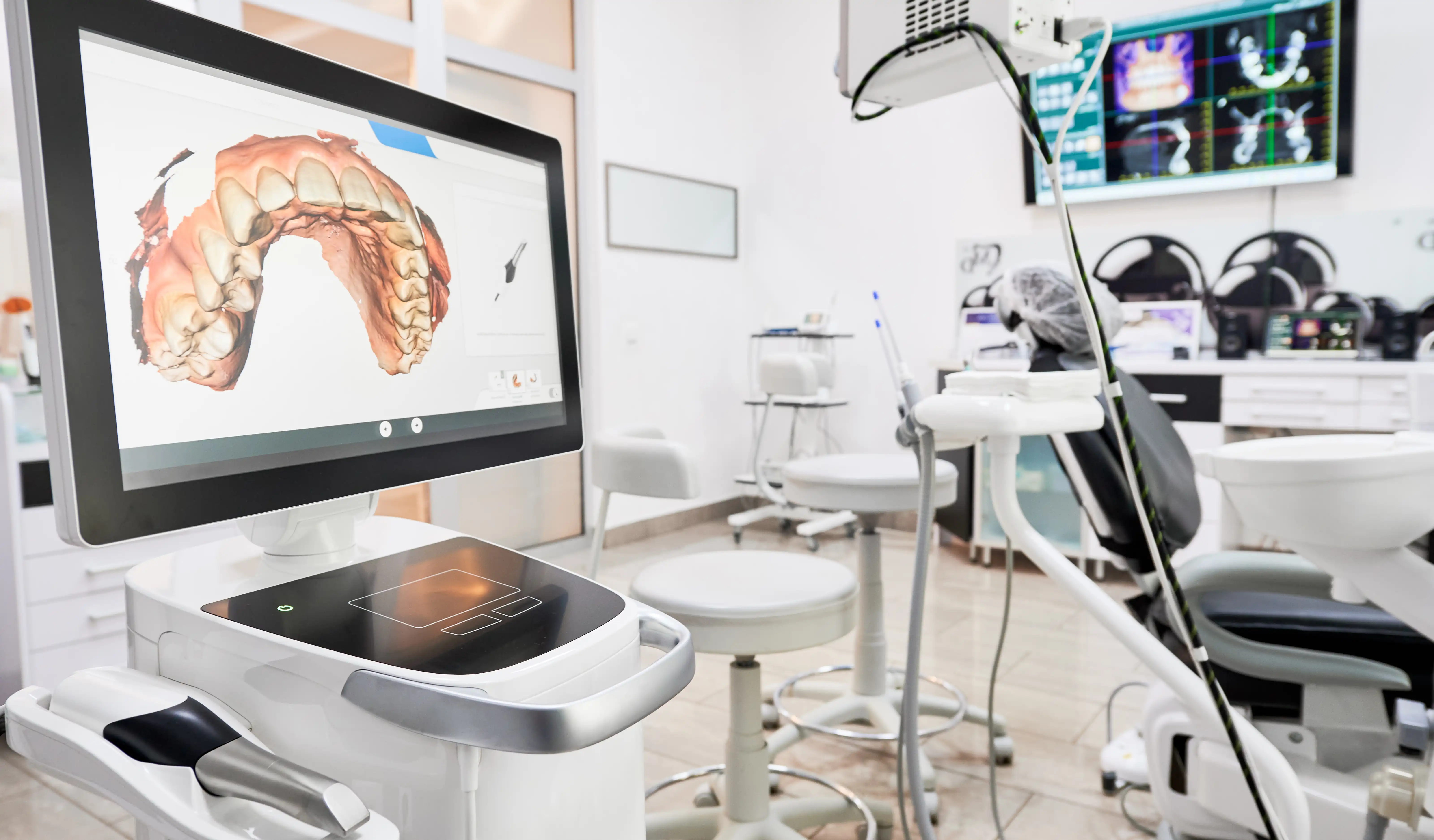 10 claves para calcular el Retorno de Inversión (ROI) de tu equipo dental
