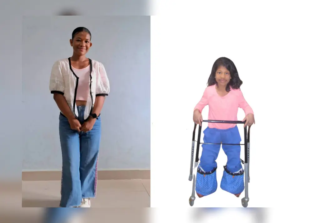 Child before and after 