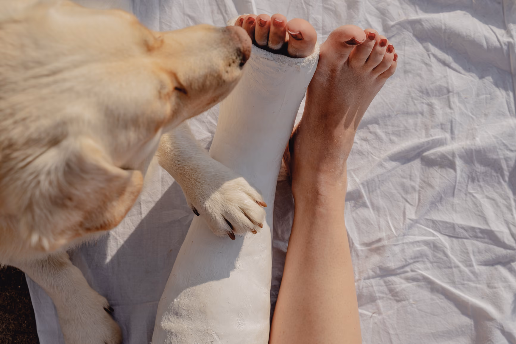 A dog paw rests on a person's leg in a white cast next to their bare foot with red nail polish.