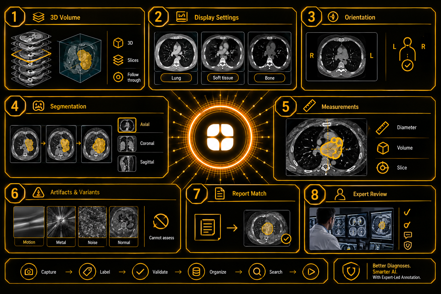 Radiology Image Annotation: Segmenting Findings, Not Just Organs
