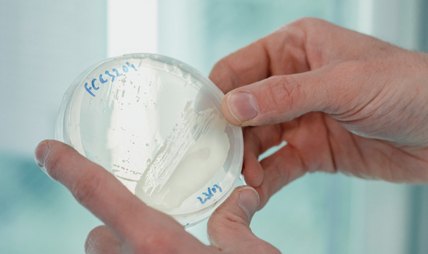 Strains Matter: Why the Right Microalgae Strain Makes All the Difference
