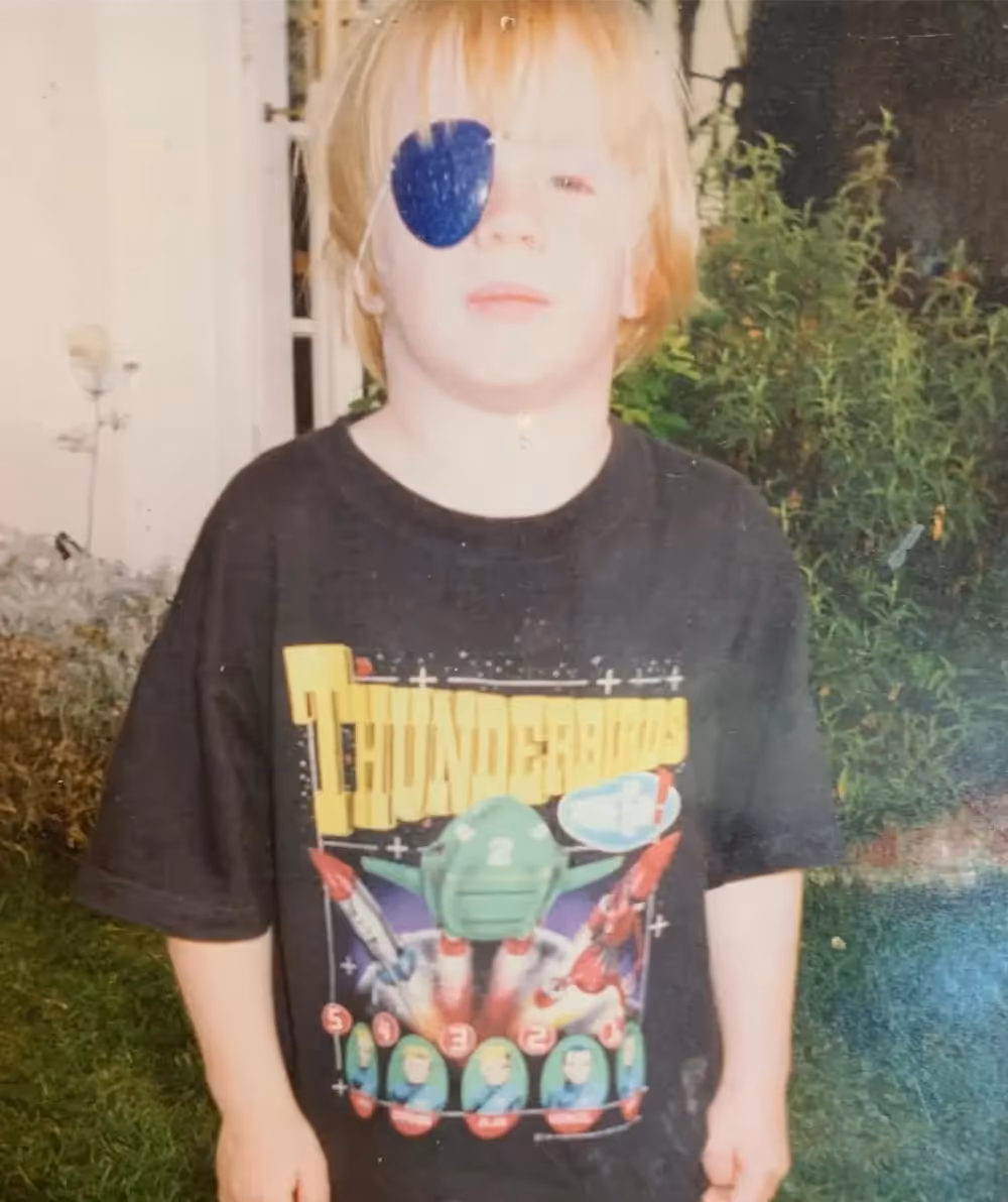 A young blonde child with long hair and an eyepatch.