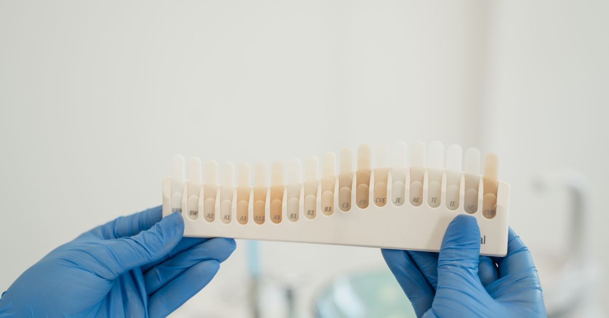Dentist holding up a tooth color guide used to match bonding material