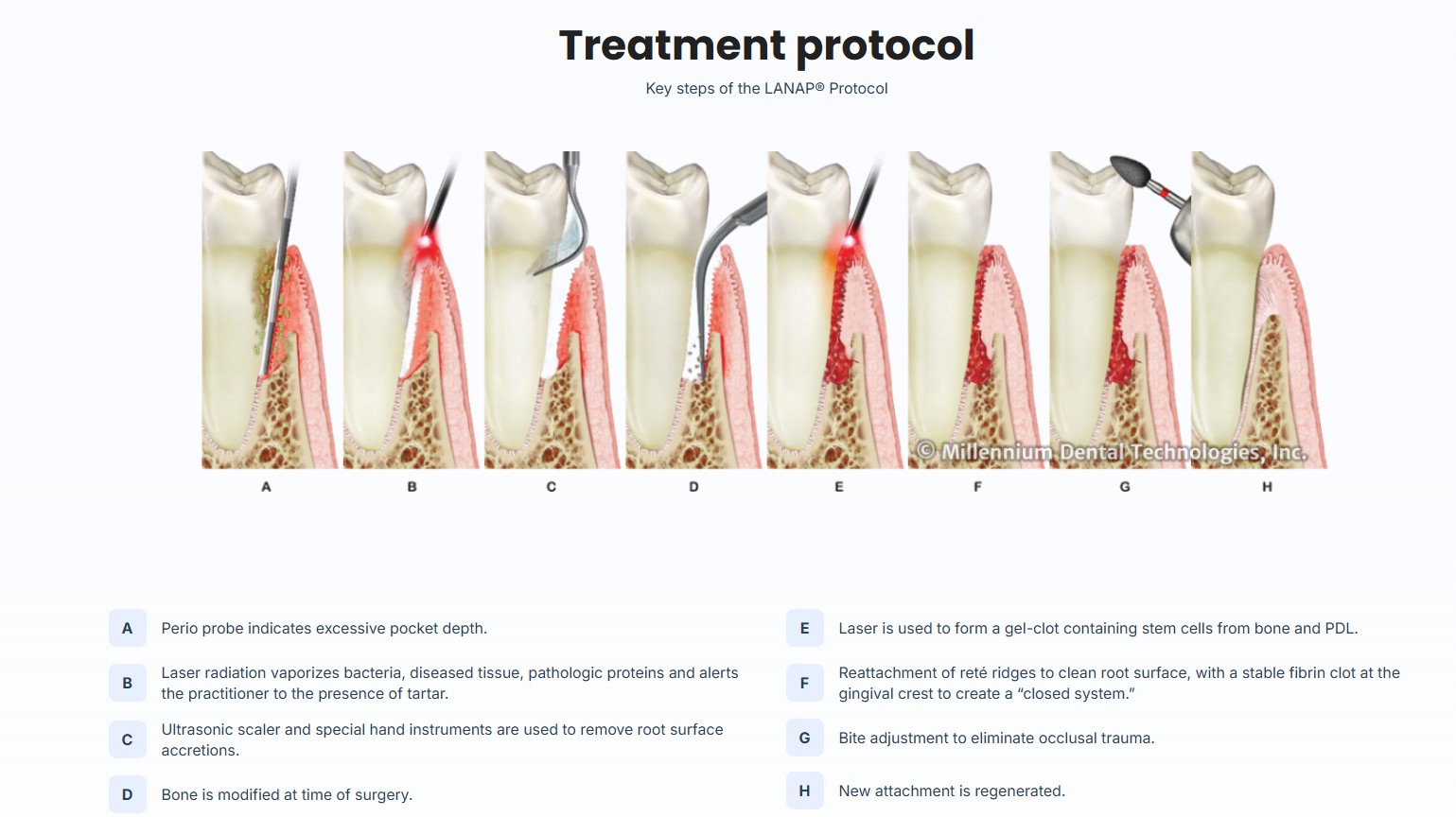 LANAP Gum Surgery Valencia