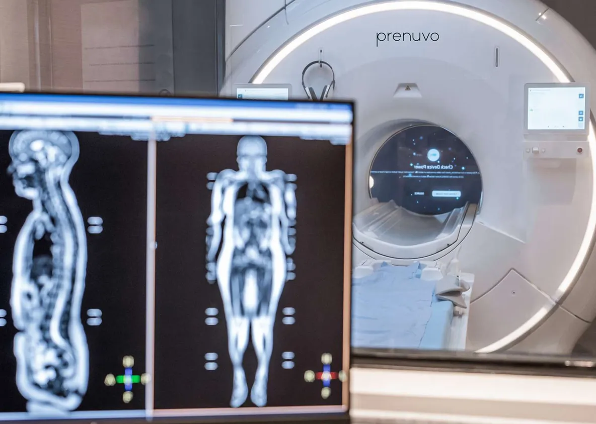 Prenuvo whole-body MRI scanner used for advanced preventive health imaging.
