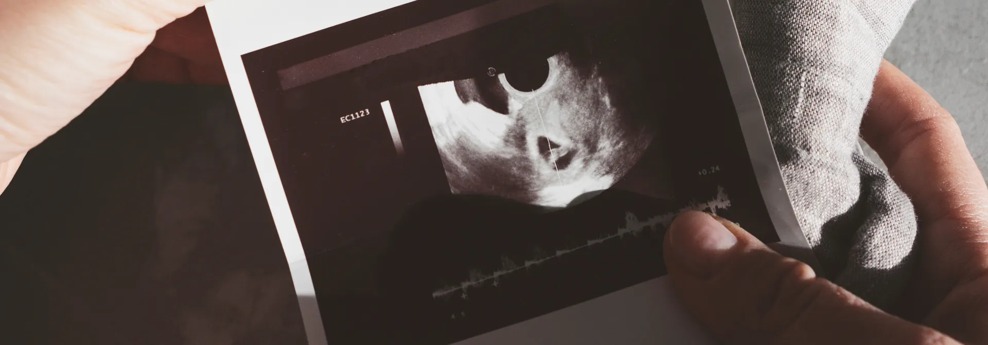 Hands holding an early pregnancy ultrasound image showing a gestational sac and heartbeat graph.