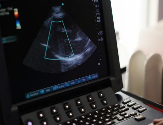 Ultrasound machine screen displaying a grayscale fetal scan with measurement boundaries.