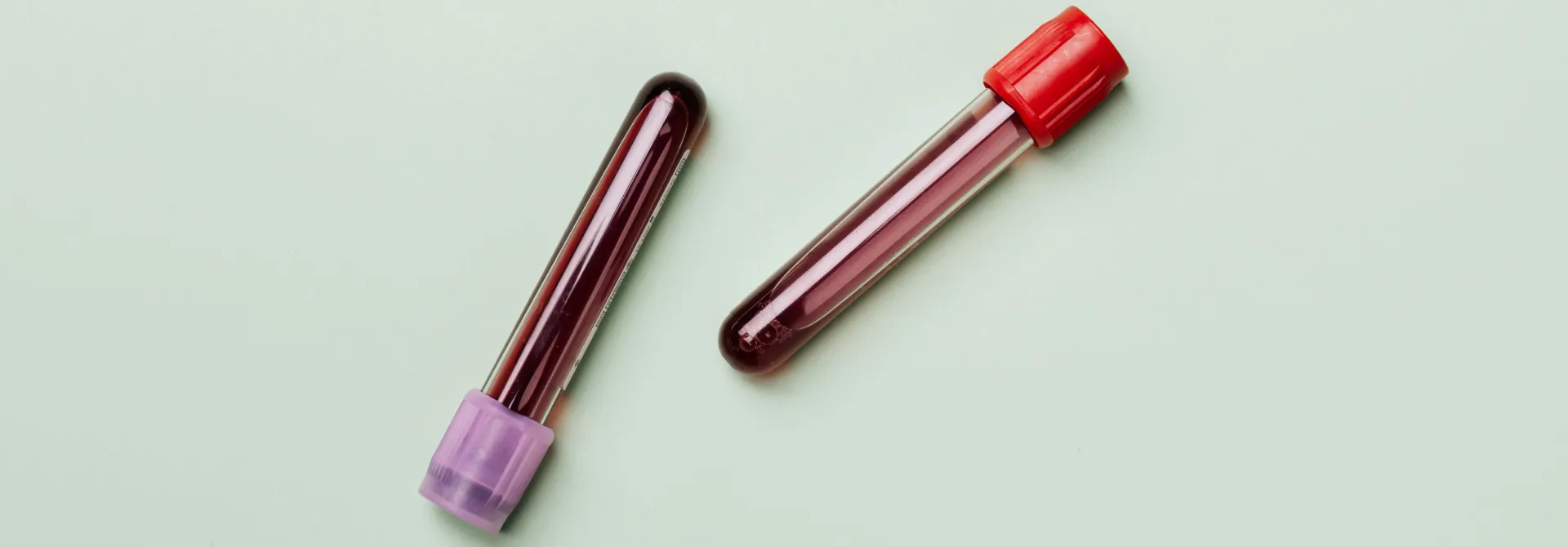 Two blood collection tubes filled with dark red blood, one with a purple cap and one with a red cap, on a light surface.