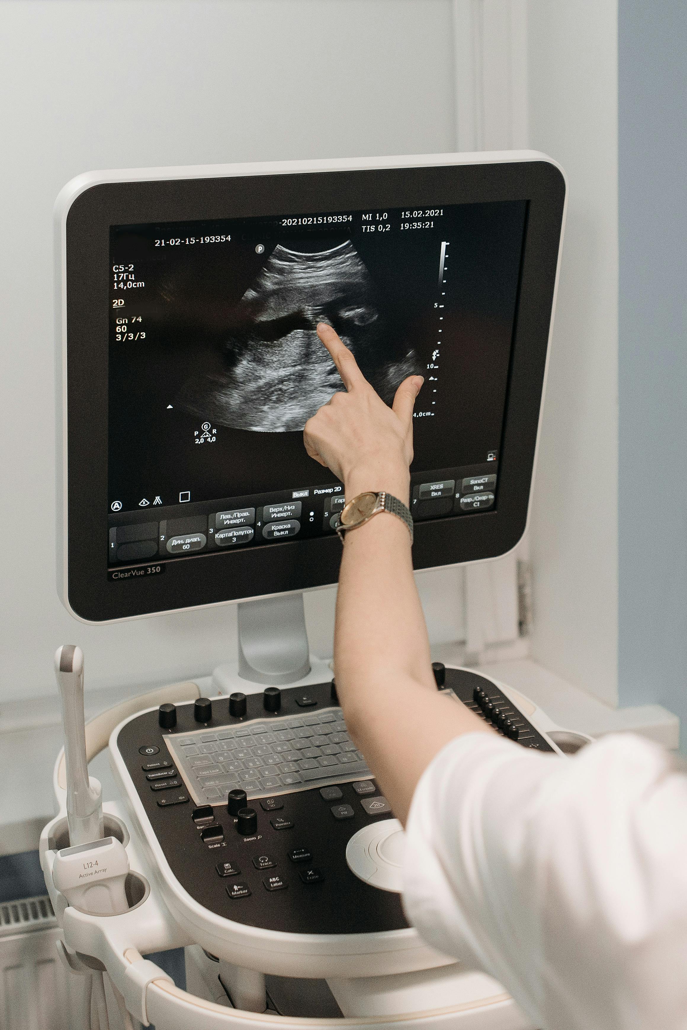 Medical professional pointing at a black and white ultrasound image on a ClearVue 350 monitor.