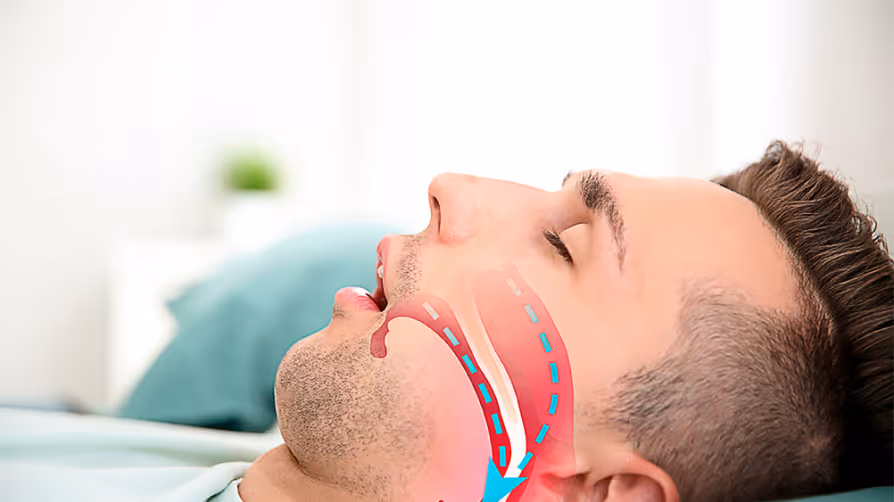  Ter o queixo para trás pode tirar o seu sono