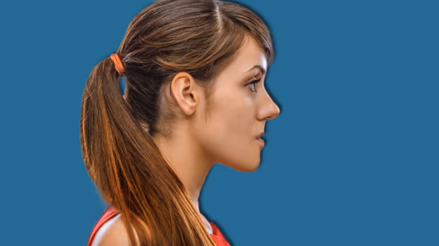 Cirurgia ortognática classe III – Explicação detalhada