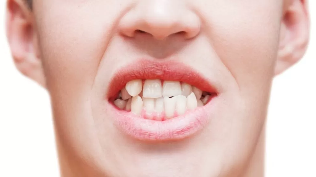 mordida cruzada sintomas