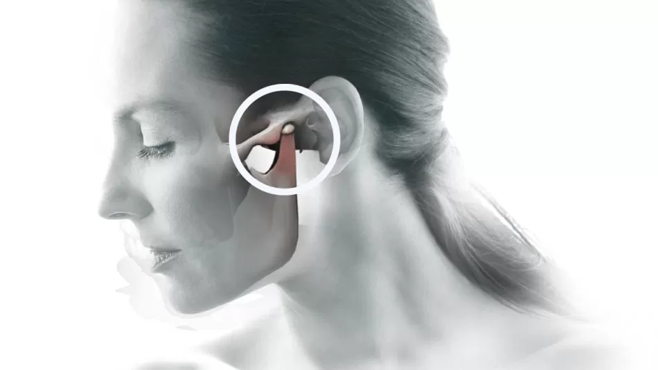 prótese de atm valor