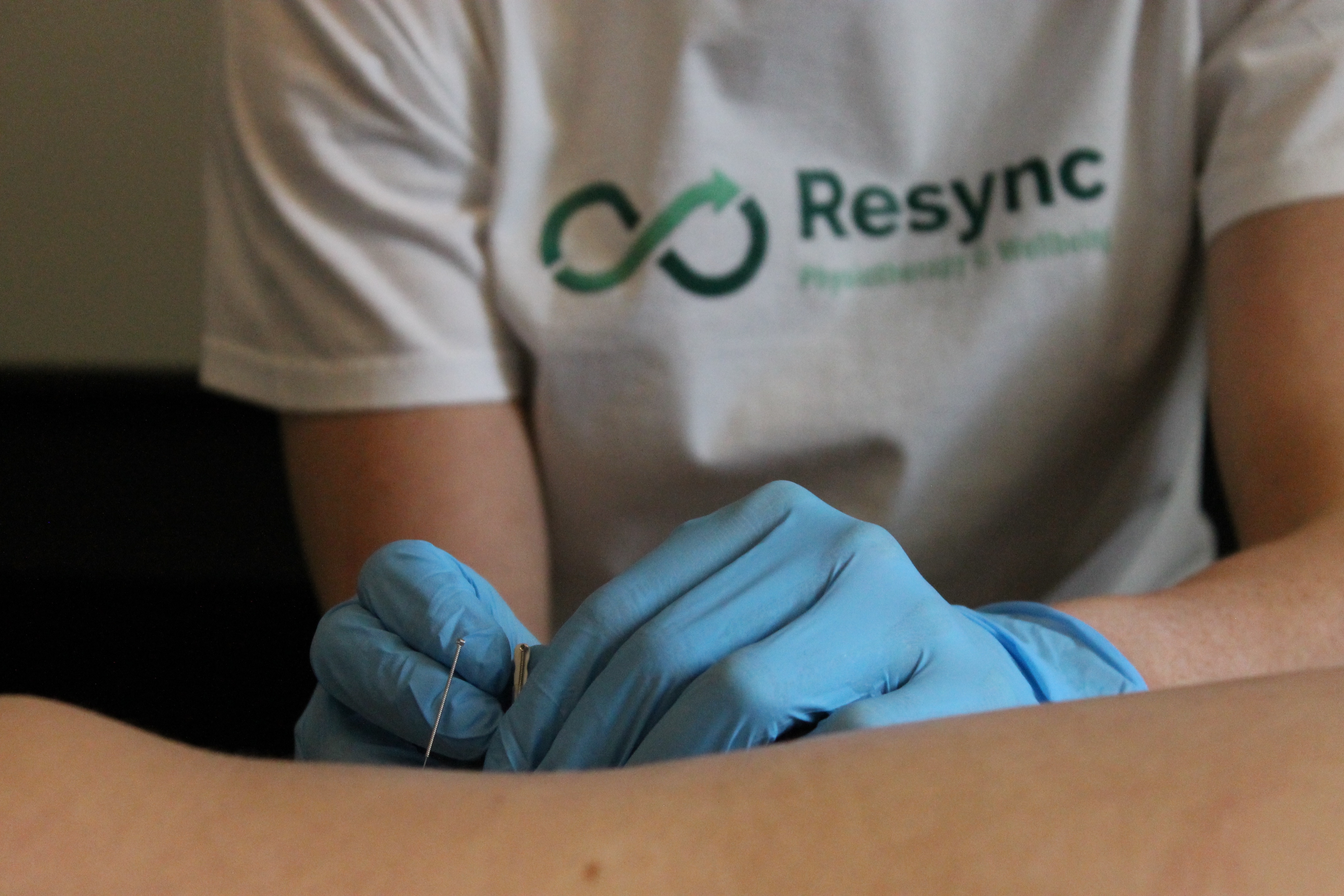 Acupuncture at Resync Physiotherapy in Balsall Common