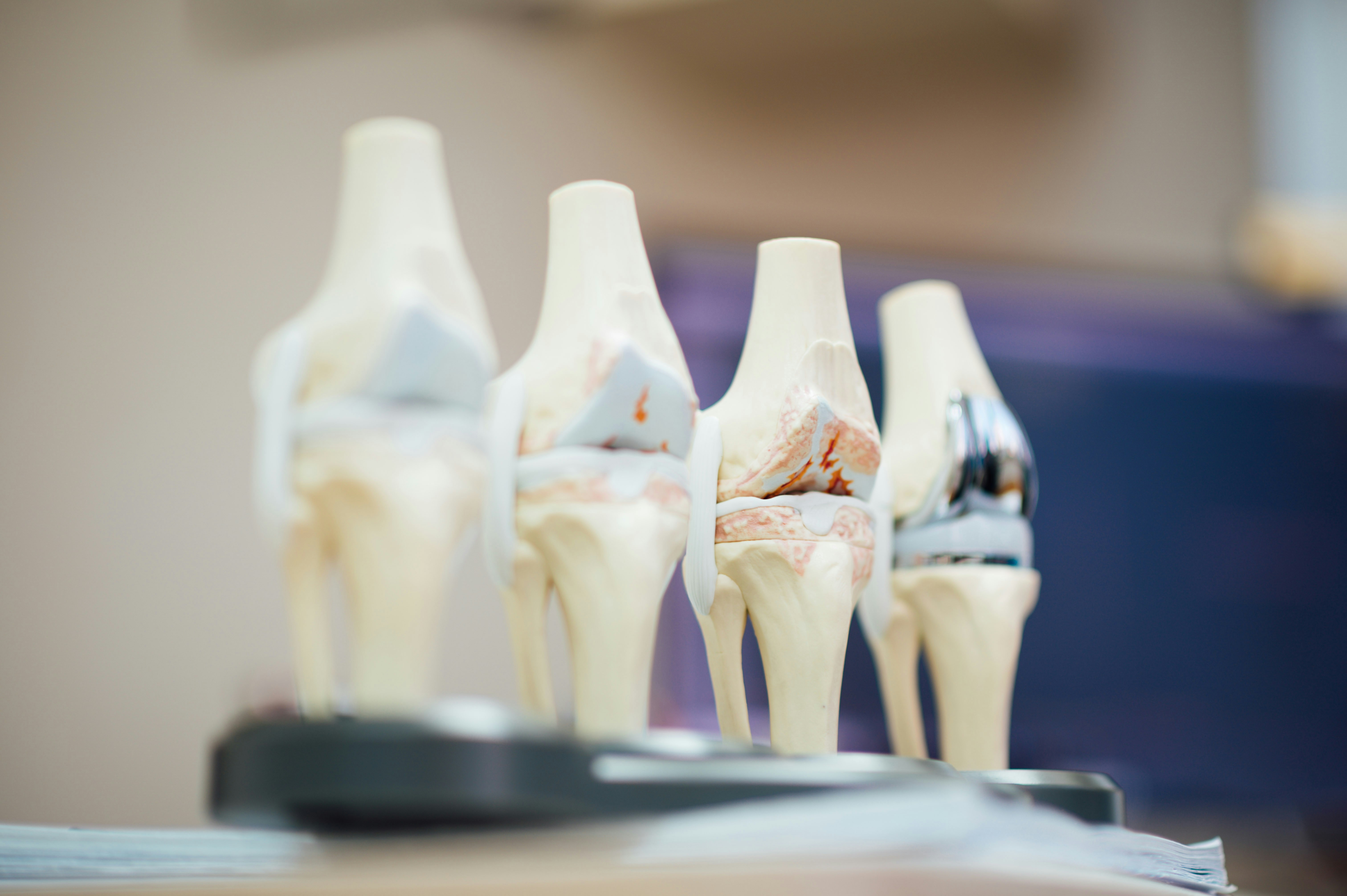 Sciatica treatment in Balsall Common