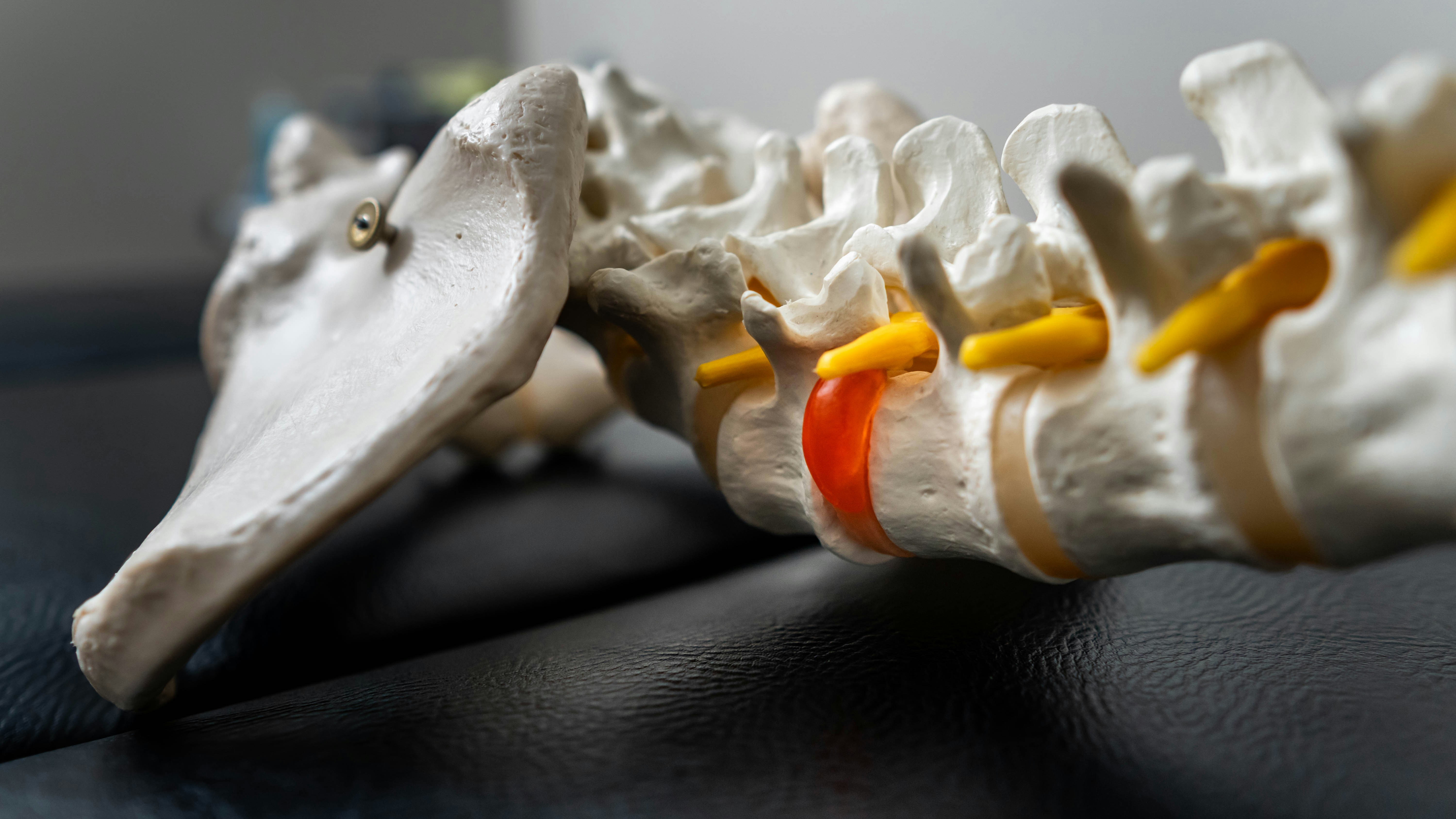 Arthritis & Joint Related Degenerative Conditions