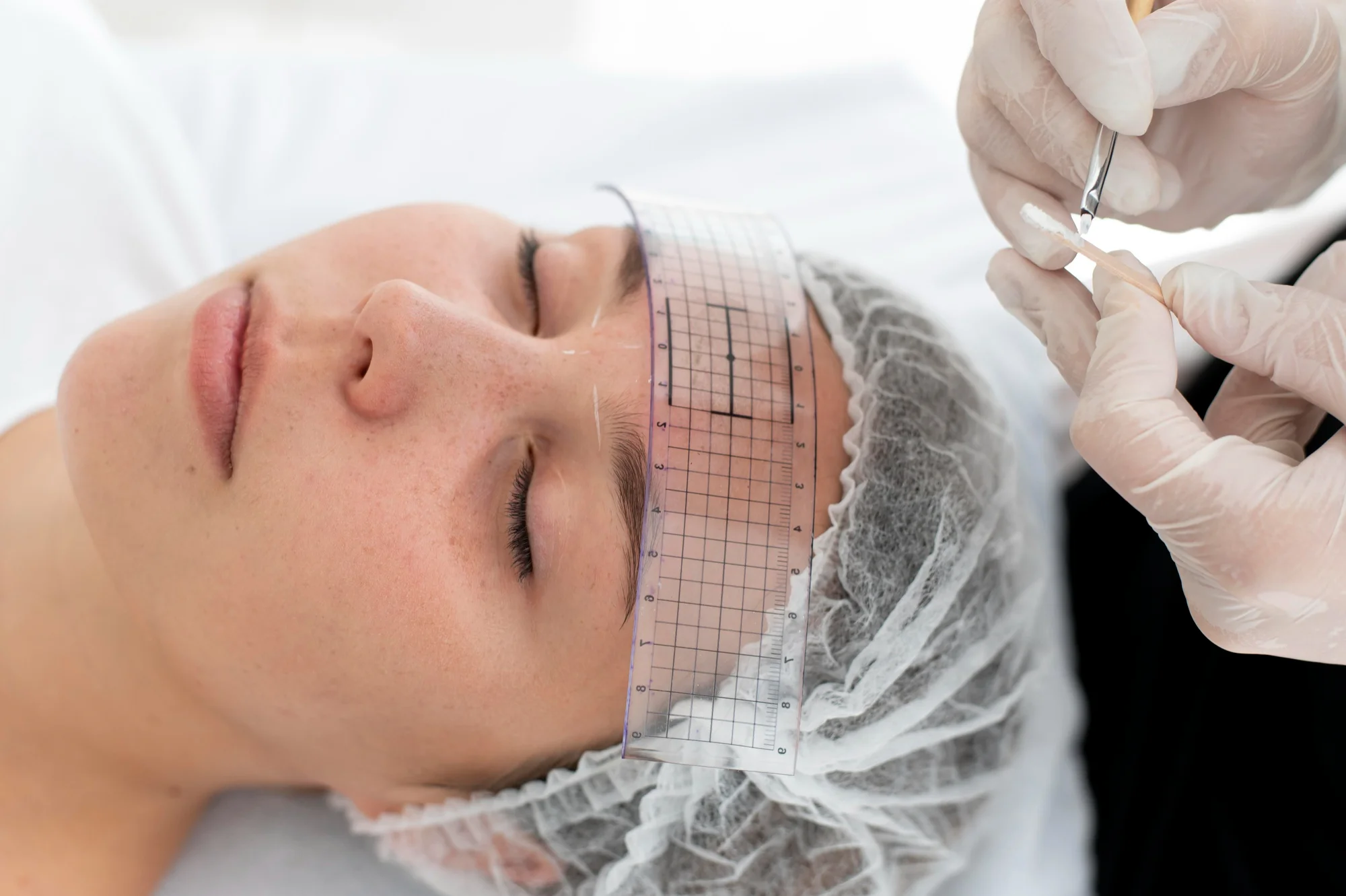 Medicina Estética Facial