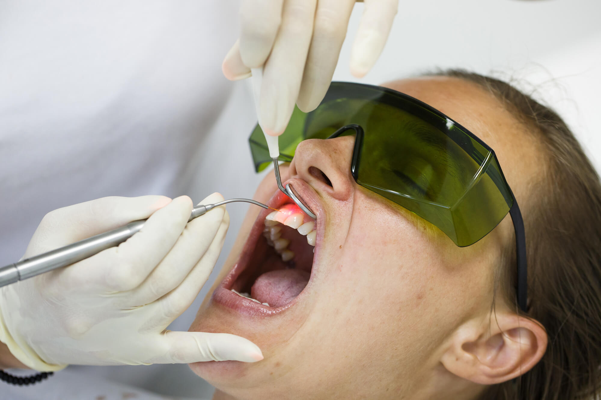 Woman getting laser periodontics treatment