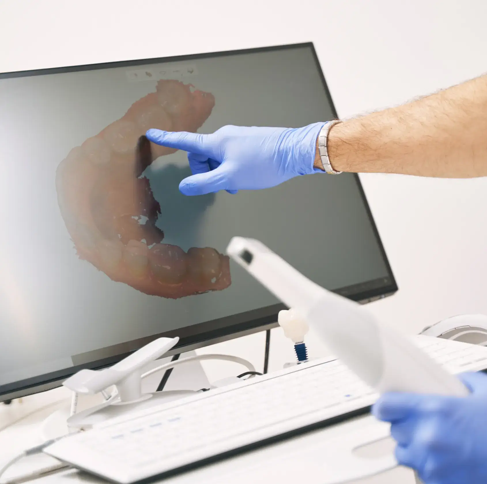 A person with blue gloves points at a dental scan on a computer screen.
