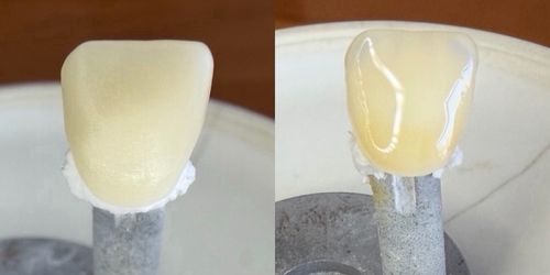 Side-by-side close-up views of a dental crown from front and back angles, mounted on a metal holder.