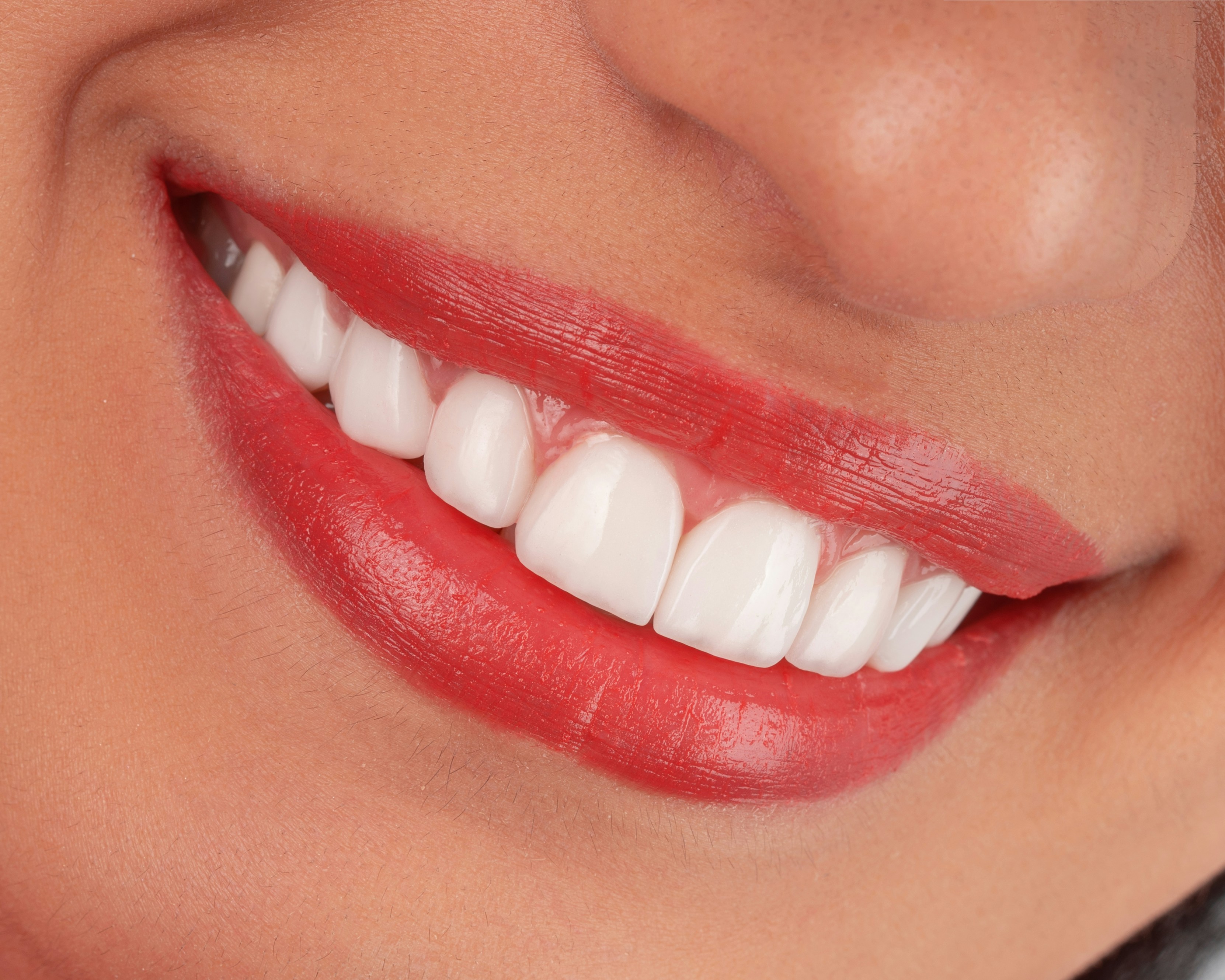 Close-up of a smiling mouth with bright white teeth and red lipstick.