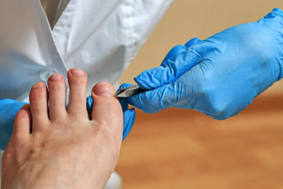 Image of a nurse using sanitized tools to clip a big toenail