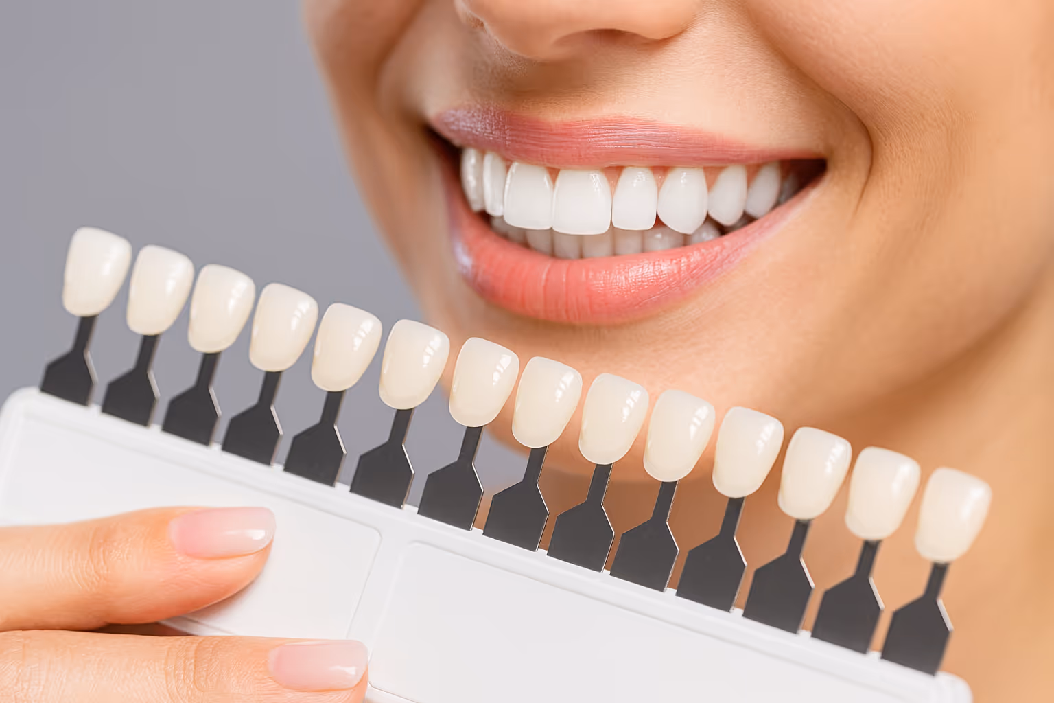 Composite Veneers at Lakeview Dental