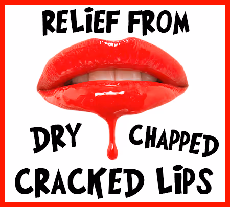Relief from Dry, Chapped, & Cracked Lips