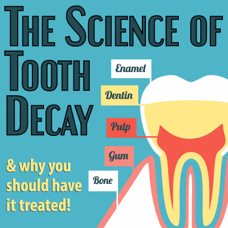 The Science of Tooth Decay
